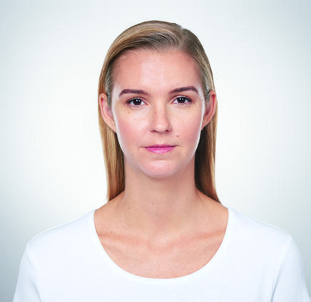 Kybella