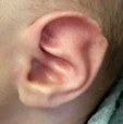 Ear Molding