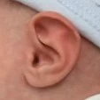 Ear Molding