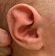 Ear Molding