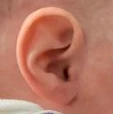 Ear Molding