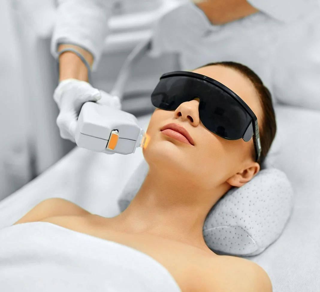 Woman getting laser resurfacing on her cheek | Co2 Laser Resurfacing | NYC