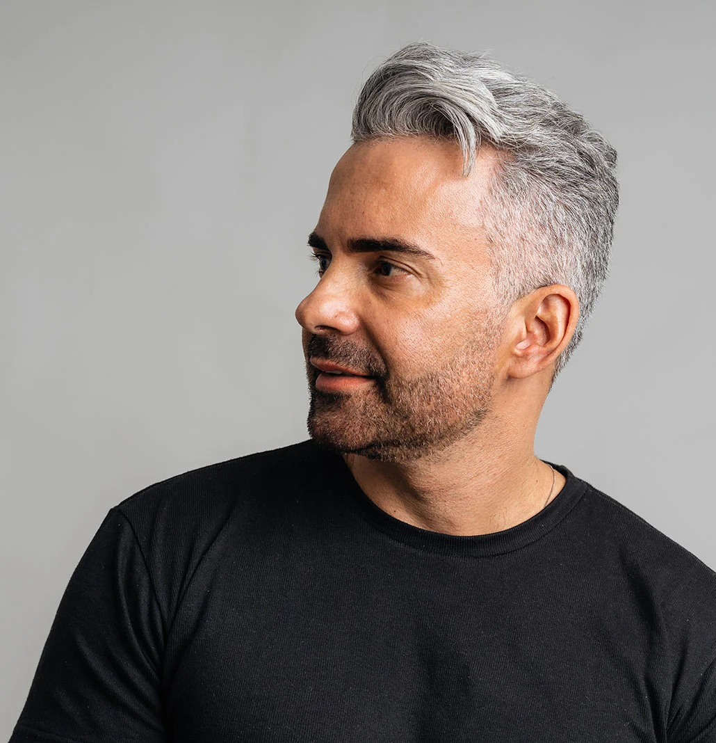 Middle aged gentleman with a healthy head of hair | Smart Graft | NYC